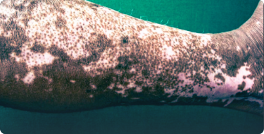 Image showing perifollicular skin repigmentation pattern