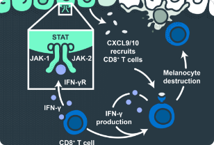 Image of JAK-STAT activation and inflammatory cycle triggering